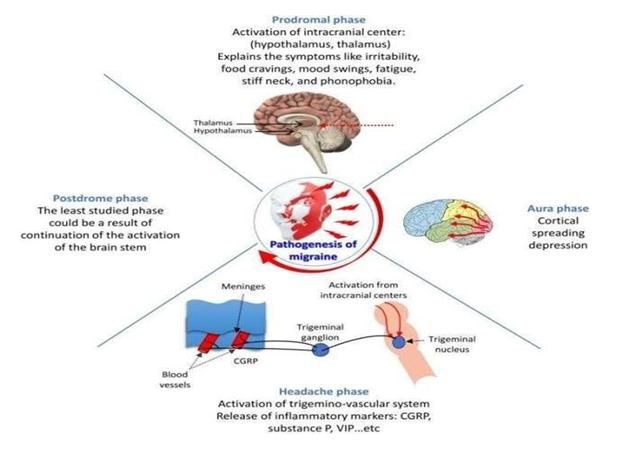 Figure 1: Conceptual illustration of the mechanisms of the different phases of migraine.